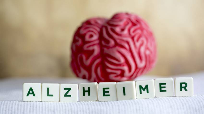 Alzheimer: Su cuidado depende de ti