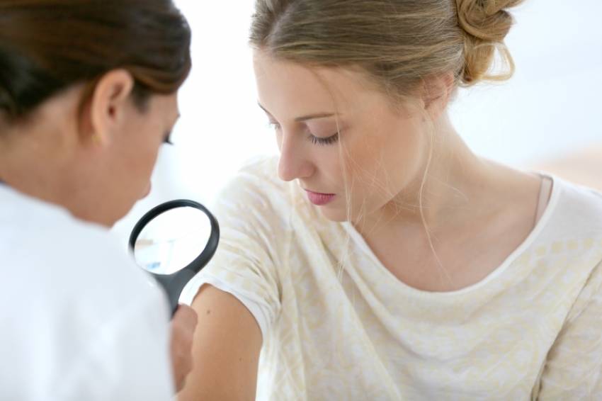 Cáncer de piel síntomas, diagnóstico y tratamiento